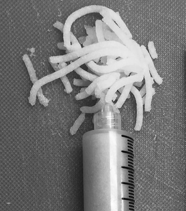 Bone Void Fillers
